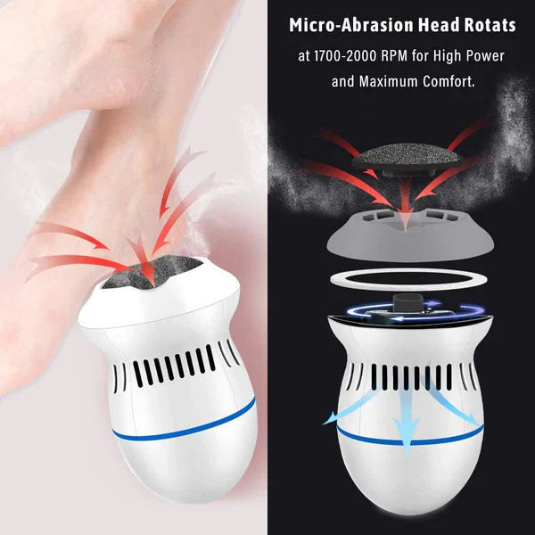 Electric Callus Remover – مزيل الجلد الميت الكهربائي
